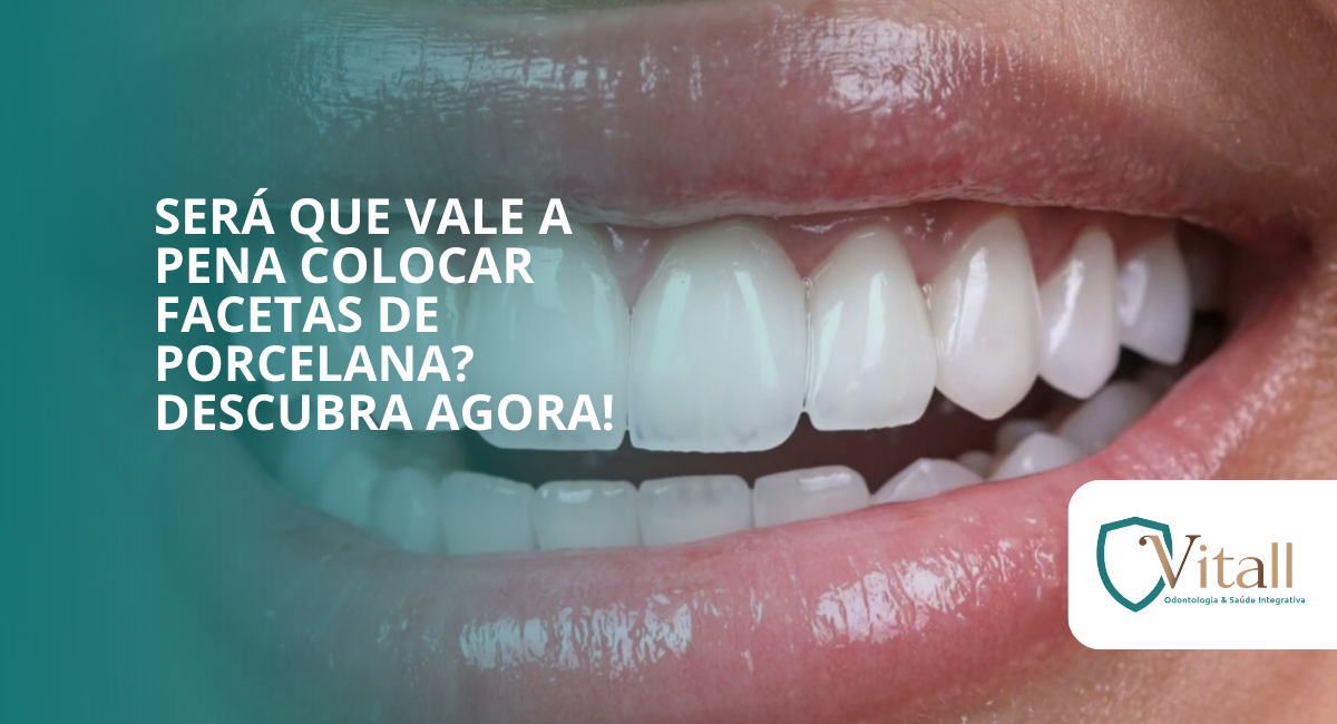 Será que vale a pena colocar facetas de porcelana? vitall check up odontologia & saúde integrativa | dentista | mogi das cruzes