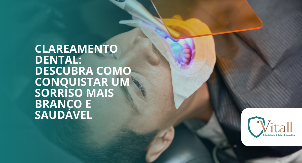 Clareamento Dental: descubra como conquistar um sorriso mais branco e saudável vitall check up odontologia & saúde integrativa | dentista | mogi das cruzes