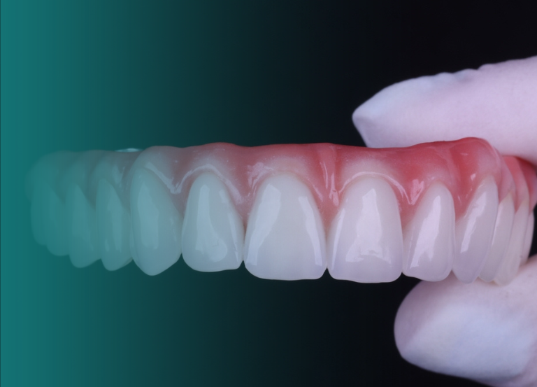 Reabilitação Oral Trabalhamos com implantes dentários, próteses e tratamentos complexos para devolver a funcionalidade e estética ao seu sorriso. Implantes Dentários: Substituição de dentes ausentes por pinos de titânio integrados ao osso, proporcionando uma base segura para coroas e próteses fixas. Próteses Dentárias: Reposição de dentes perdidos com próteses fixas (coroas e pontes) ou removíveis (dentaduras). Tratamento de DTM: Correção de problemas na articulação da mandíbula, aliviando dores e melhorando a mastigação. Vitall Check-Up Odontologia & Saúde Integrativa | Dentista | Mogi das Cruzes