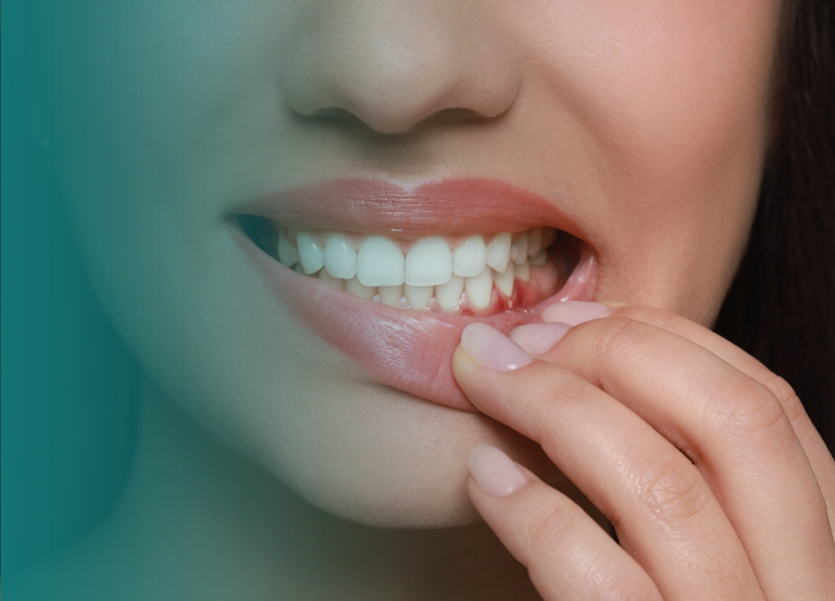 Periodontia Tratamos gengivite, periodontite e outras doenças da gengiva, garantindo a saúde dos tecidos que sustentam os dentes. Tratamento de Gengivite e Periodontite: Controle e tratamento de inflamações na gengiva e nos ossos que suportam os dentes. Enxertos Gengivais: Procedimentos para reparar áreas onde houve perda de tecido gengival. Cirurgias Periodontais: Correção de problemas estéticos e funcionais envolvendo gengivas e ossos ao redor dos dentes. Vitall Check-Up Odontologia & Saúde Integrativa | Dentista | Mogi das Cruzes