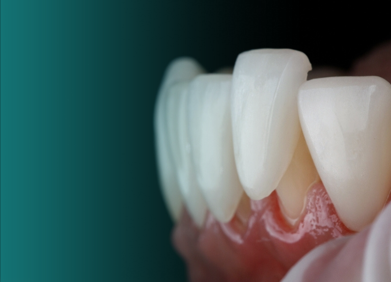 Estética Dental Melhoramos a aparência do seu sorriso com clareamentos, facetas de porcelana e restaurações estéticas. Clareamento Dental: Técnica para clarear os dentes, removendo manchas e amarelamento. Facetas e Lentes em Resina ou Porcelana: Fina camada de resina ou porcelana aplicada sobre os dentes para melhorar a cor, formato e alinhamento. Restaurações Estéticas: Uso de resina composta para restaurar dentes danificados de maneira natural e esteticamente agradável. Vitall Check-Up Odontologia & Saúde Integrativa | Dentista | Mogi das Cruzes