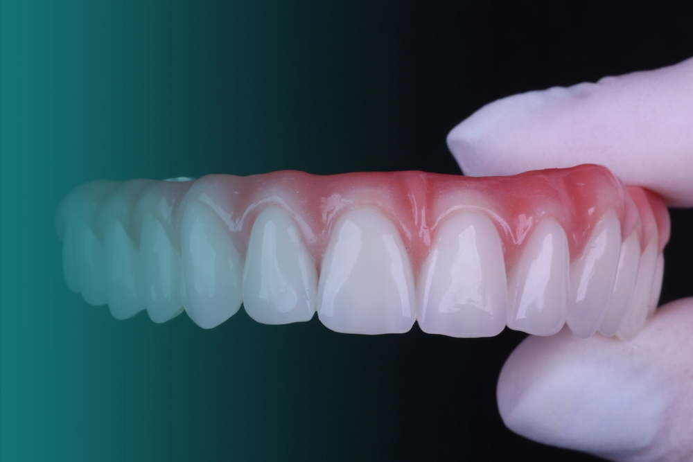 Implante Dentário em Mogi das Cruzes Vitall Check-Up Odontologia & Saúde Integrativa | Dentista | Mogi das Cruzes