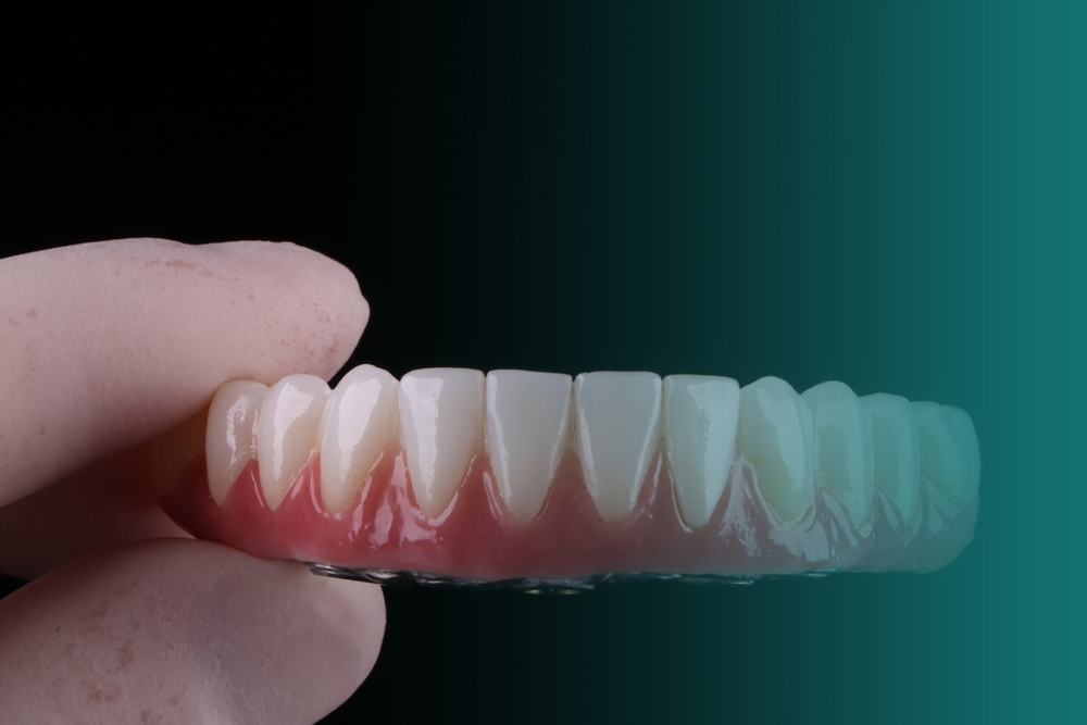 Por que optar pelo Implante Dentário? Vitall Check-Up Odontologia & Saúde Integrativa | Dentista | Mogi das Cruzes