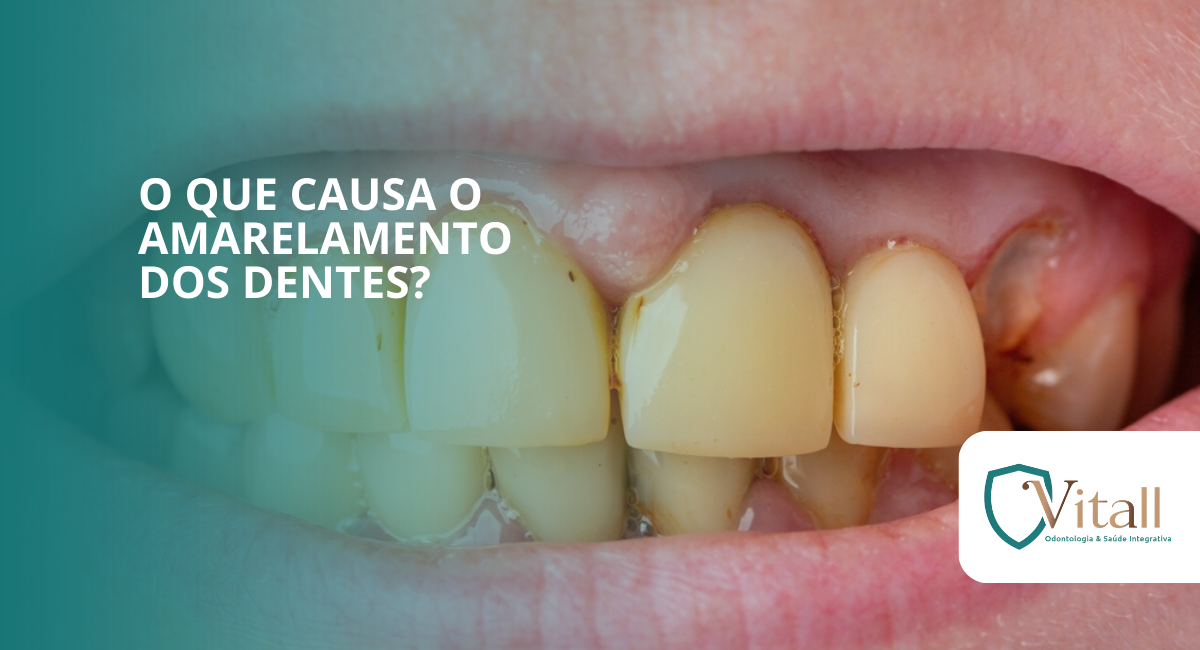 O que causa o amarelamento dos dentes? vitall check up odontologia & saúde integrativa | dentista | mogi das cruzes