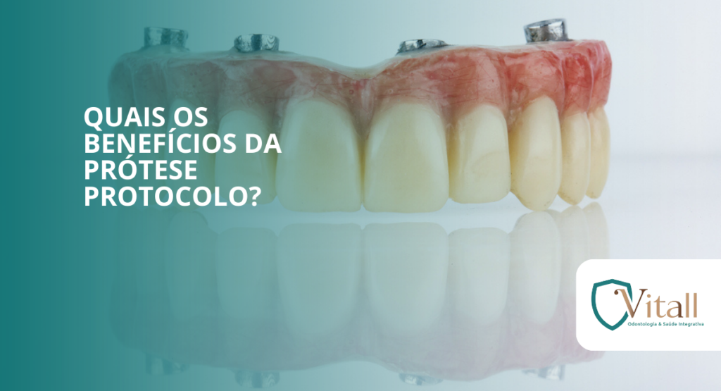 Quais os benefícios da prótese protocolo? vitall check up odontologia & saúde integrativa | dentista | mogi das cruzes