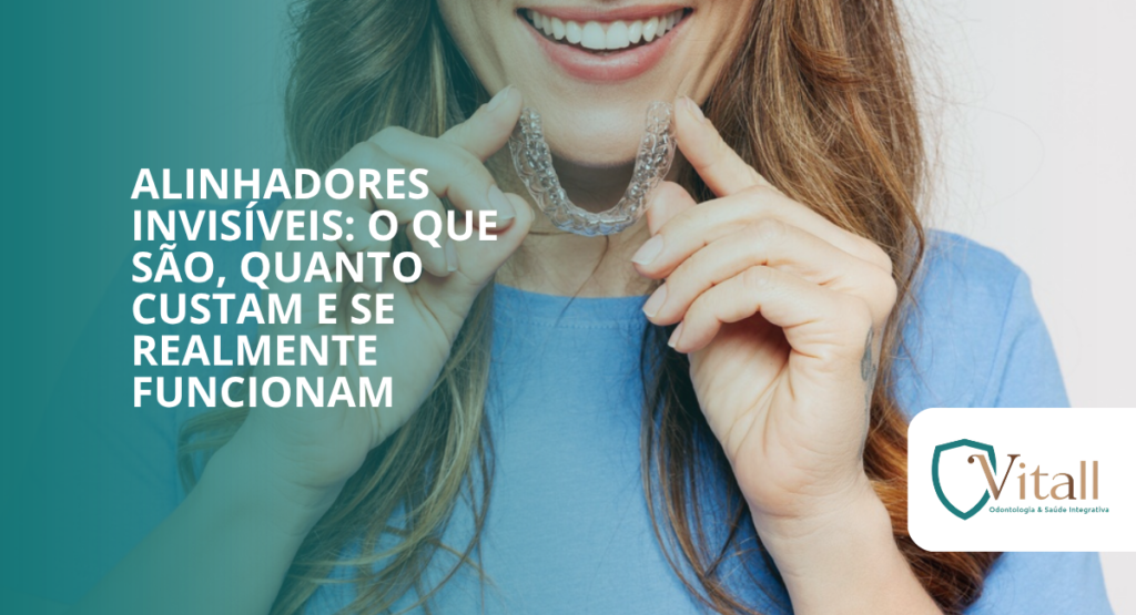 Alinhadores invisíveis: o que são, quanto custam e se realmente funcionam - vitall checkup odontologia & saude integrativa