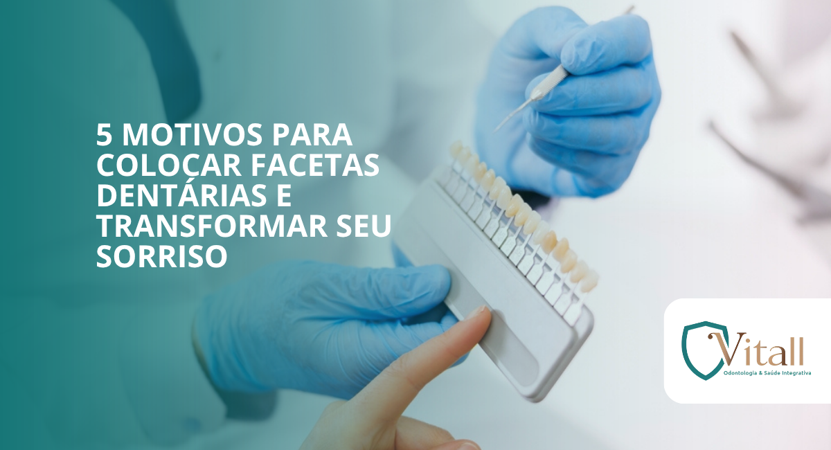 5 motivos para colocar facetas dentárias e transformar seu sorriso - vitall odontologia & saúde integrativa | dentista | mogi das cruzes