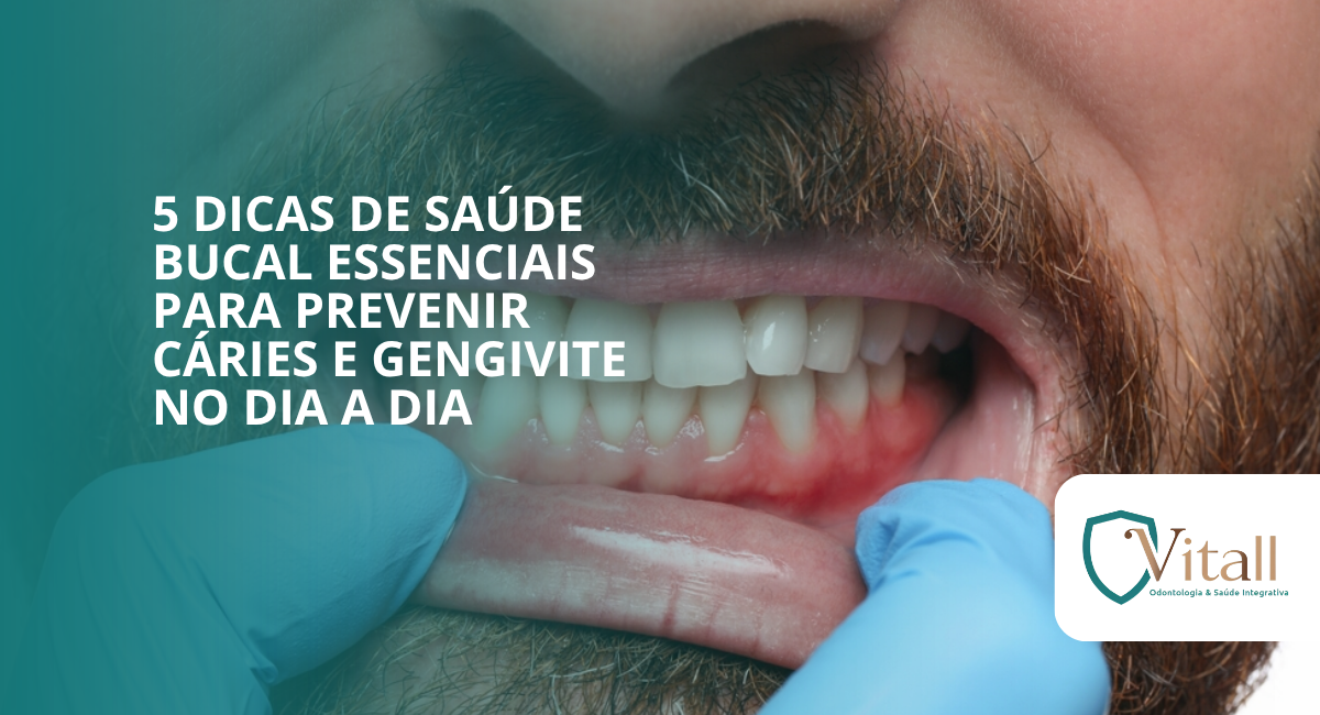 5 dicas de saúde bucal essenciais para prevenir cáries e gengivite no dia a dia - vitall odontologia & saúde integrativa | dentista | mogi das cruzes