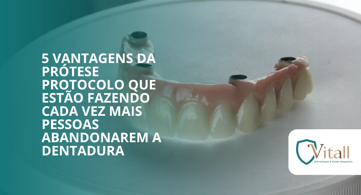 Blog Vitall - 5 vantagens da prótese protocolo que estão fazendo cada vez mais pessoas abandonarem a dentadura