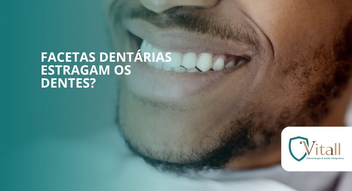 Blog Vitall - Facetas dentárias estragam os dentes? Descubra a verdade que ninguém explica direito