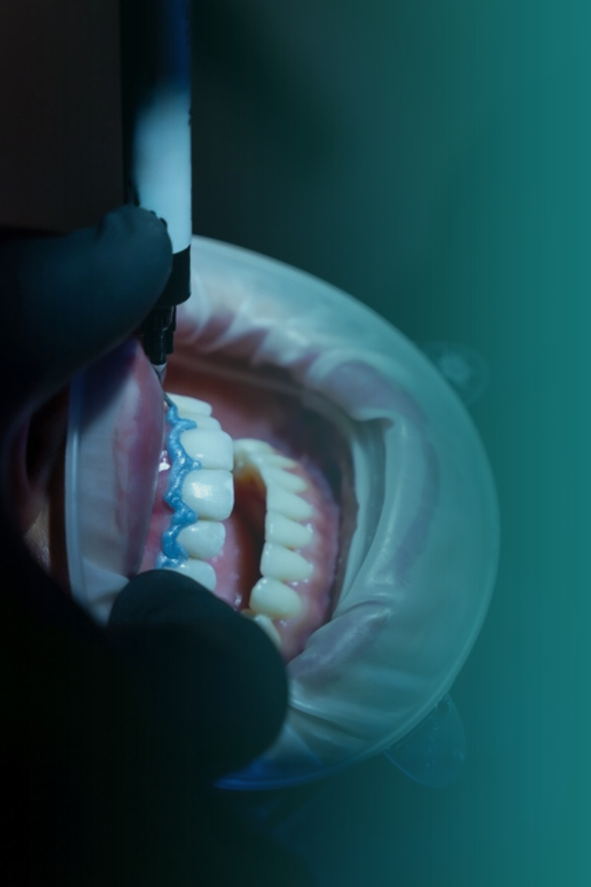 sorriso-branco-apos-clareamento-dental-mogi-das-cruzes - Vitall Odontologia & Saúde Integrativa | Dentista Mogi das Cruzes
