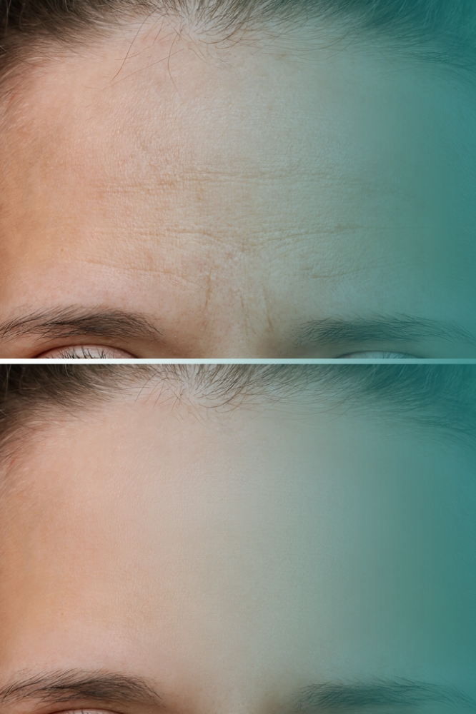 O que é Harmonização Orofacial - Vitall Odontologia & Saúde Integrativa | Dentista Mogi das Cruzes