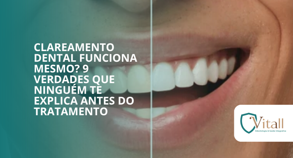 Clareamento dental funciona mesmo? 9 verdades que ninguém te explica antes do tratamento - Vitall Odontologia & Saúde Integrativa | Dentista Mogi das Cruzes