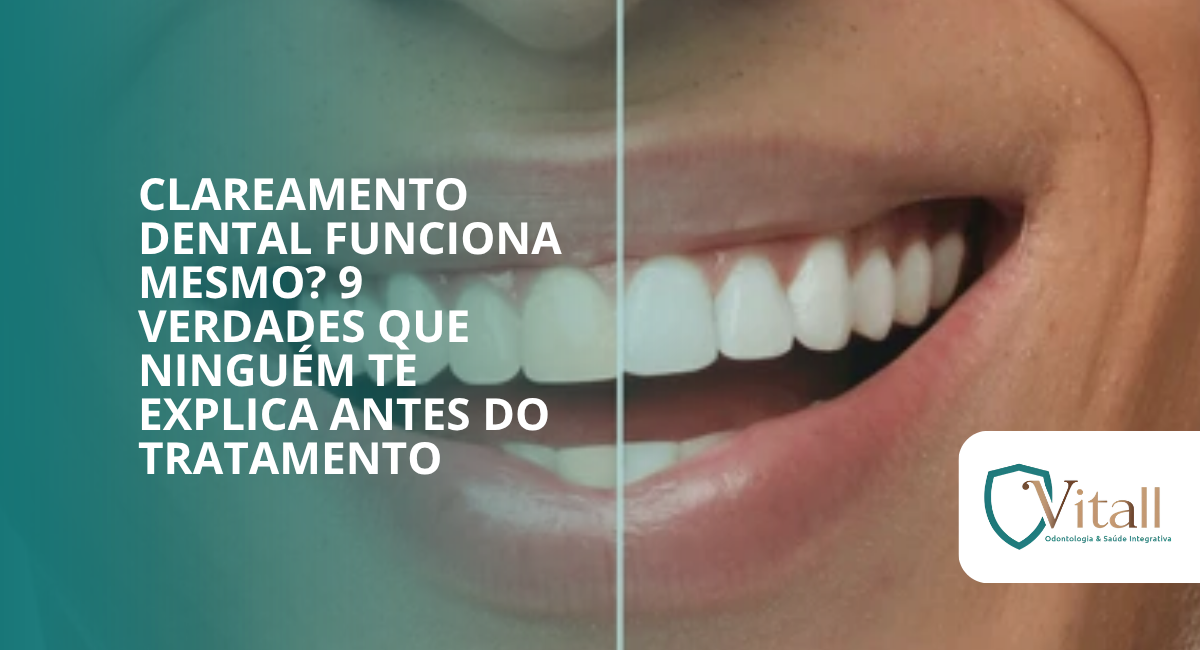 Clareamento dental funciona mesmo? 9 verdades que ninguém te explica antes do tratamento - Vitall Odontologia & Saúde Integrativa | Dentista Mogi das Cruzes