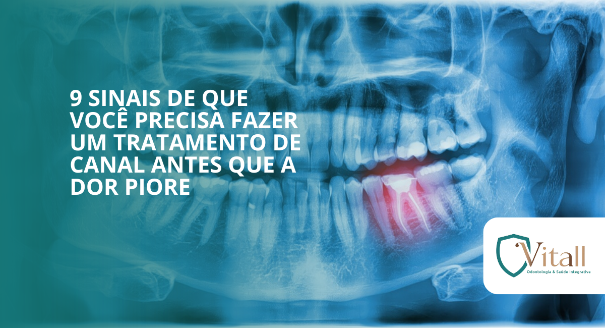 9 sinais de que você precisa fazer um tratamento de canal antes que a dor piore - vitall odontologia & saúde integrativa | dentista mogi das cruzes